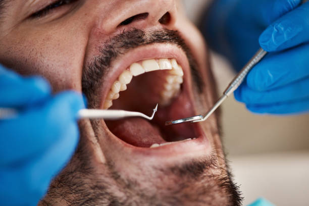 Best Emergency Tooth Extraction in Yoncalla, OR