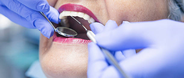 Best Emergency Root Canal Treatment in Yoncalla, OR